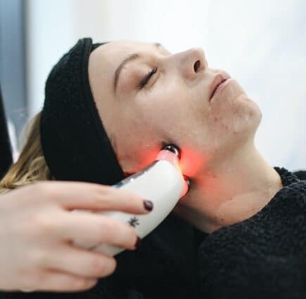 Treating stubborn Acne with Technology