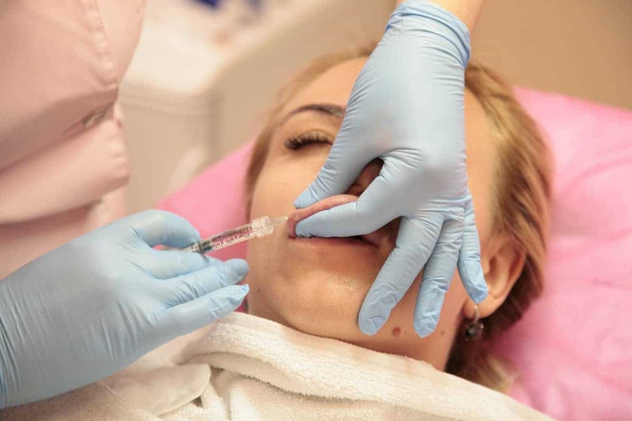 All About Lip Lift Surgery